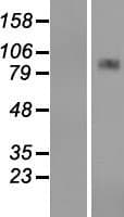 CPT1A Protein (Over-Expression Lysate Myc-DDK (Flag))
