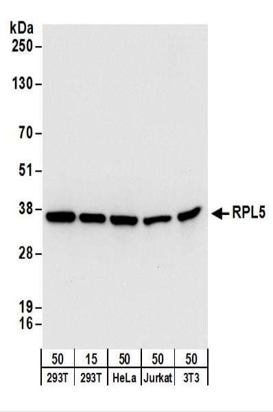 IHC-plus™ RPL5 / Ribosomal Protein L5 Antibody (aa247-297)