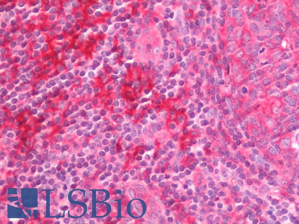 IHC-plus™ PCNA-Associated Factor Antibody