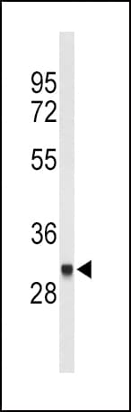 FCGR1B Antibody (aa248-276)