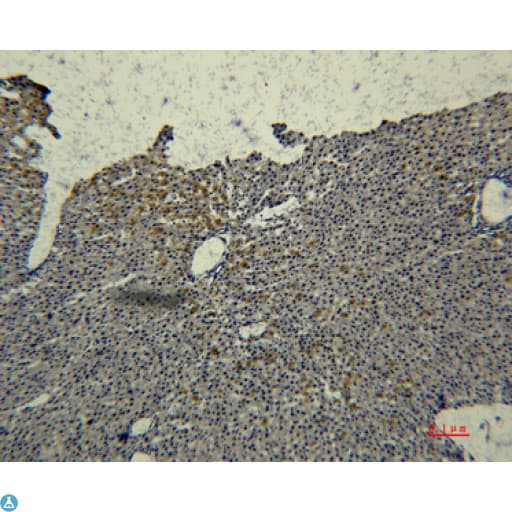 TF / Transferrin Antibody