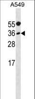 IHC-plus™ MYF5 / MYF 5 Antibody (aa7-36)