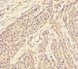 RBM17 Antibody