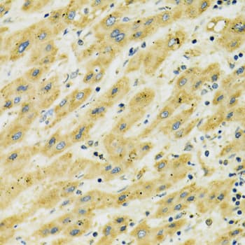 Polyclonal Rabbit anti-Human HSPA9 / Mortalin / GRP75 Antibody (IHC, IF, WB)
