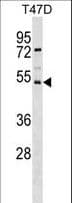 Polyclonal Rabbit anti-Human SVOPL Antibody (aa241-269, WB)