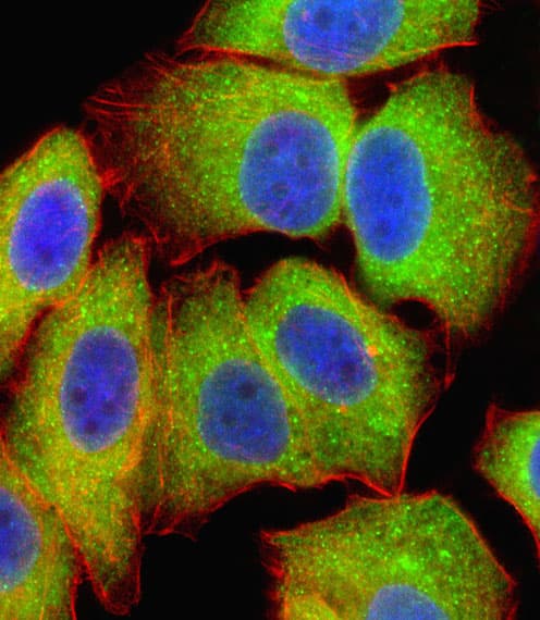 Polyclonal Rabbit anti-Human RELA / NFKB p65 Antibody (aa166-195, IF, WB)