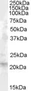 Polyclonal Goat anti-Human FGF21 Antibody (aa103-115, WB)