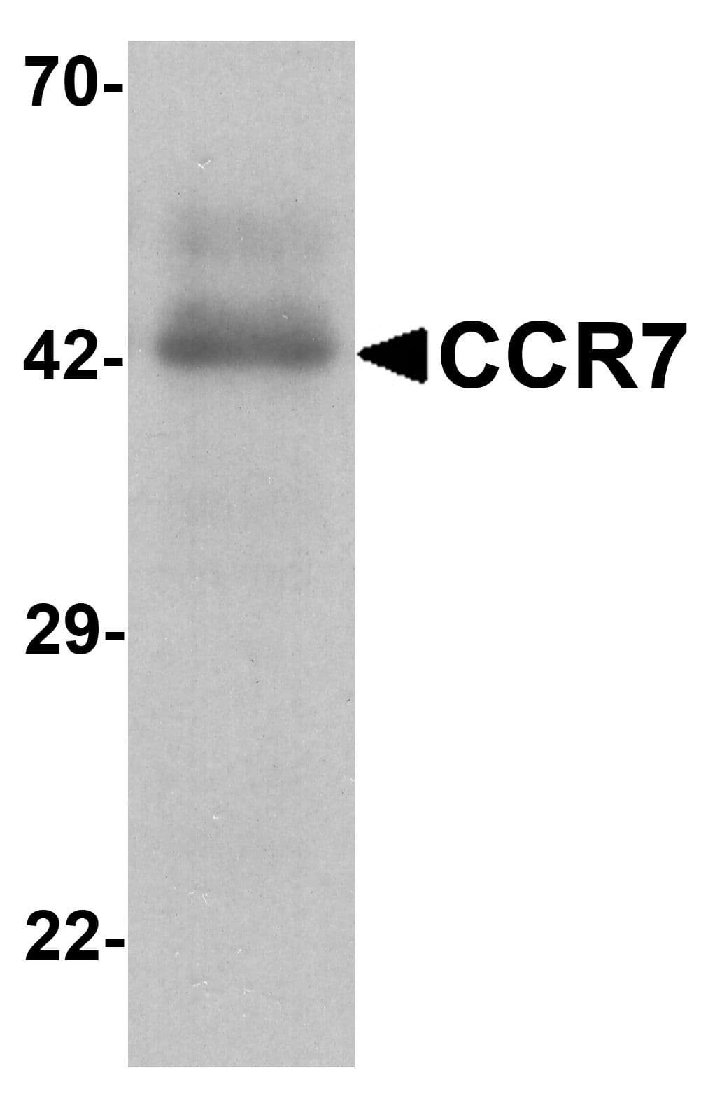 Polyclonal Rabbit anti-Human CCR7 Antibody (IHC, IF, WB)