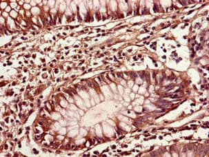IOP1 / NARFL Antibody