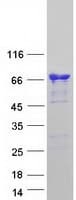 Human CAMKK1 Protein (Recombinant Myc-DDK (Flag))