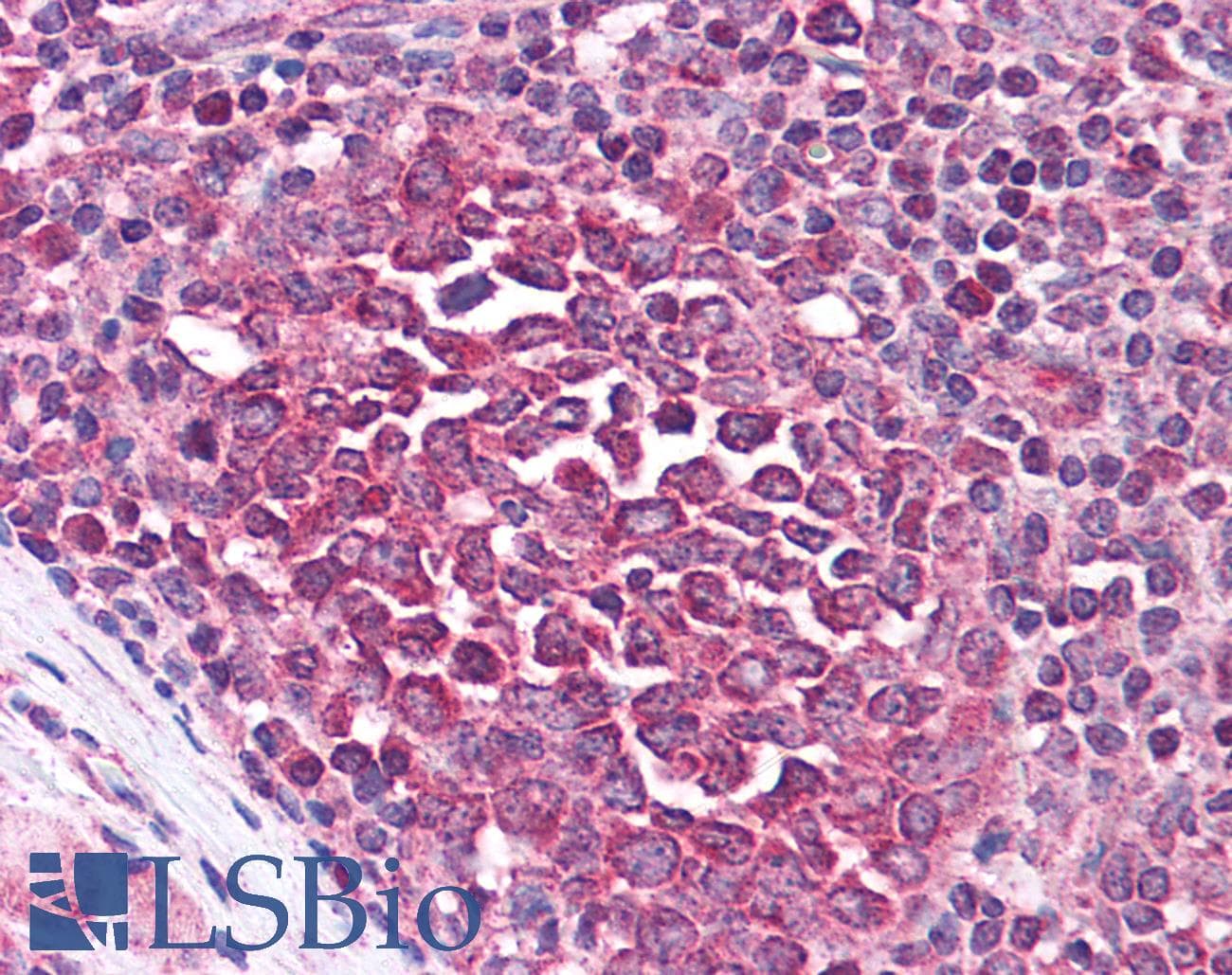 IHC-plus™ Polyclonal Rabbit anti-Human IRAK3 / IRAKM / IRAK-M Antibody (IHC, IF, WB)