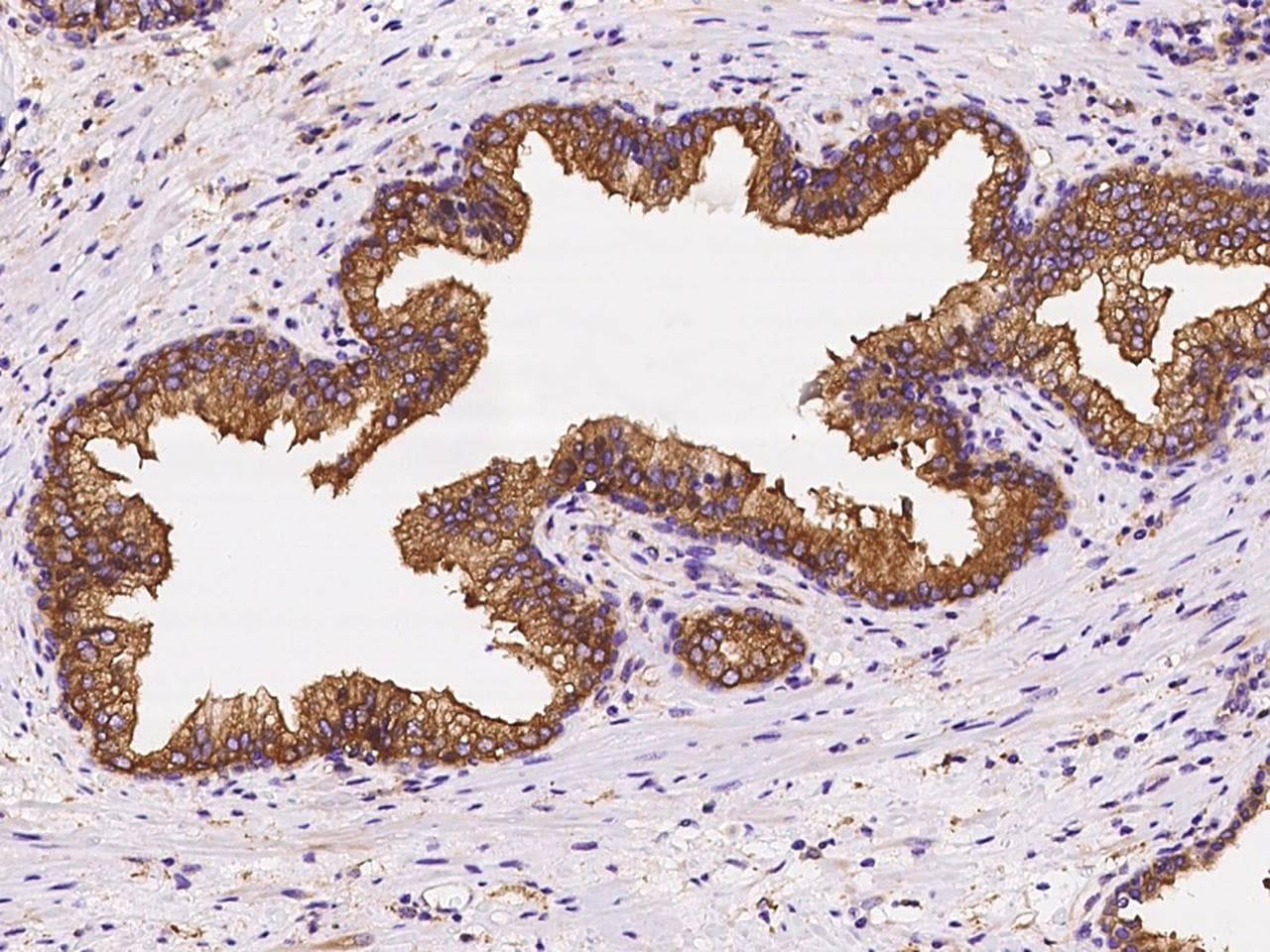 Polyclonal Rabbit anti-Human CORO1B Antibody (IHC)