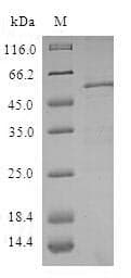 Human ZWINT Protein (Recombinant GST, N-terminus)