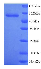 Human GPC6 / Glypican 6 Protein (Recombinant His)