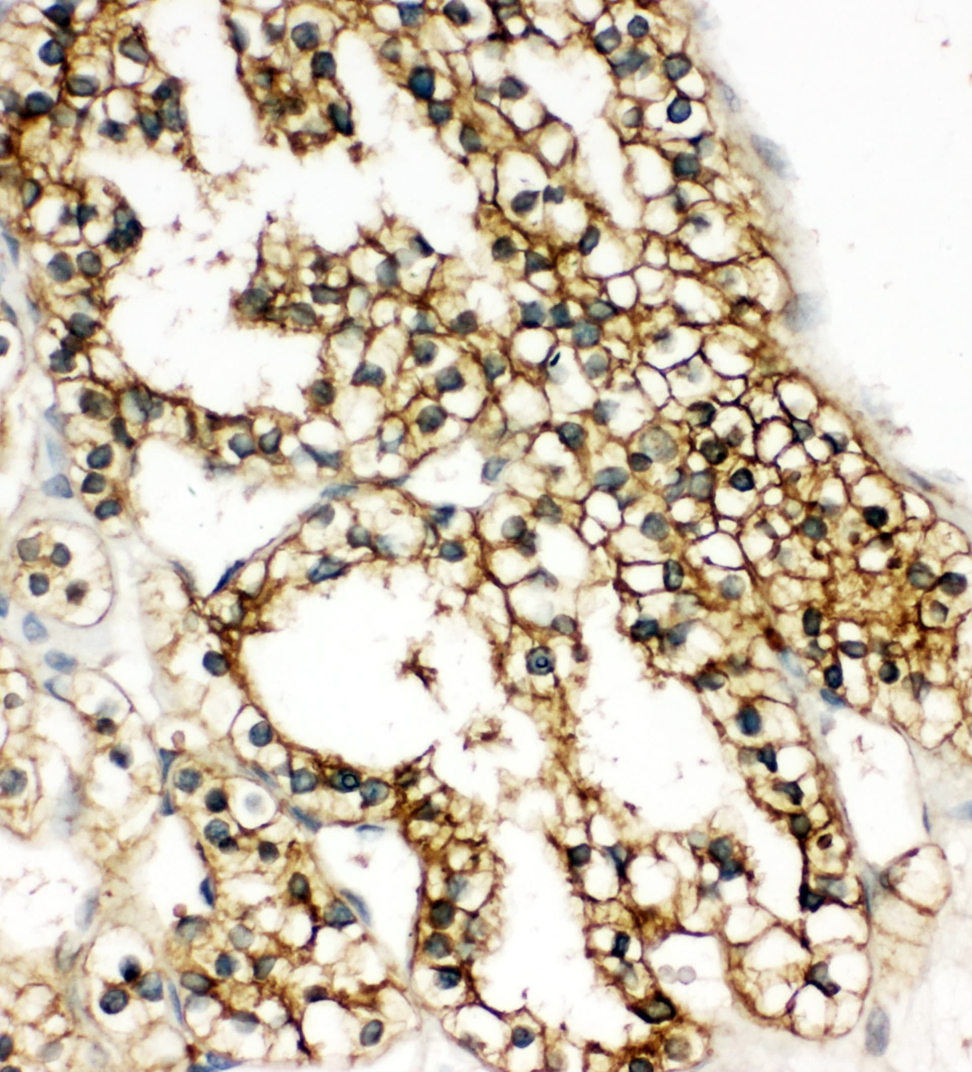 COMT Antibody (aa94-108)