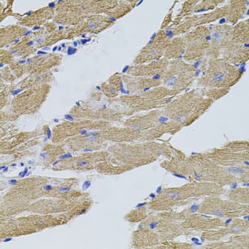 CAST / Calpastatin Antibody