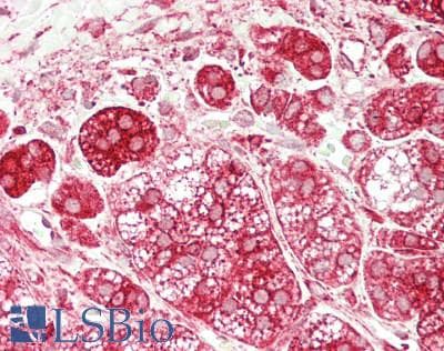 Polyclonal Rabbit anti-Human GLA / Alpha Galactosidase Antibody (aa1-80, IHC, WB)