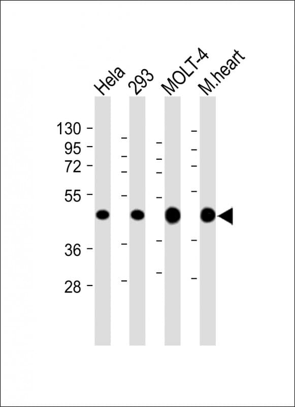 MTHFD2 Antibody (C-Terminus, clone 1985CT220.118.31)
