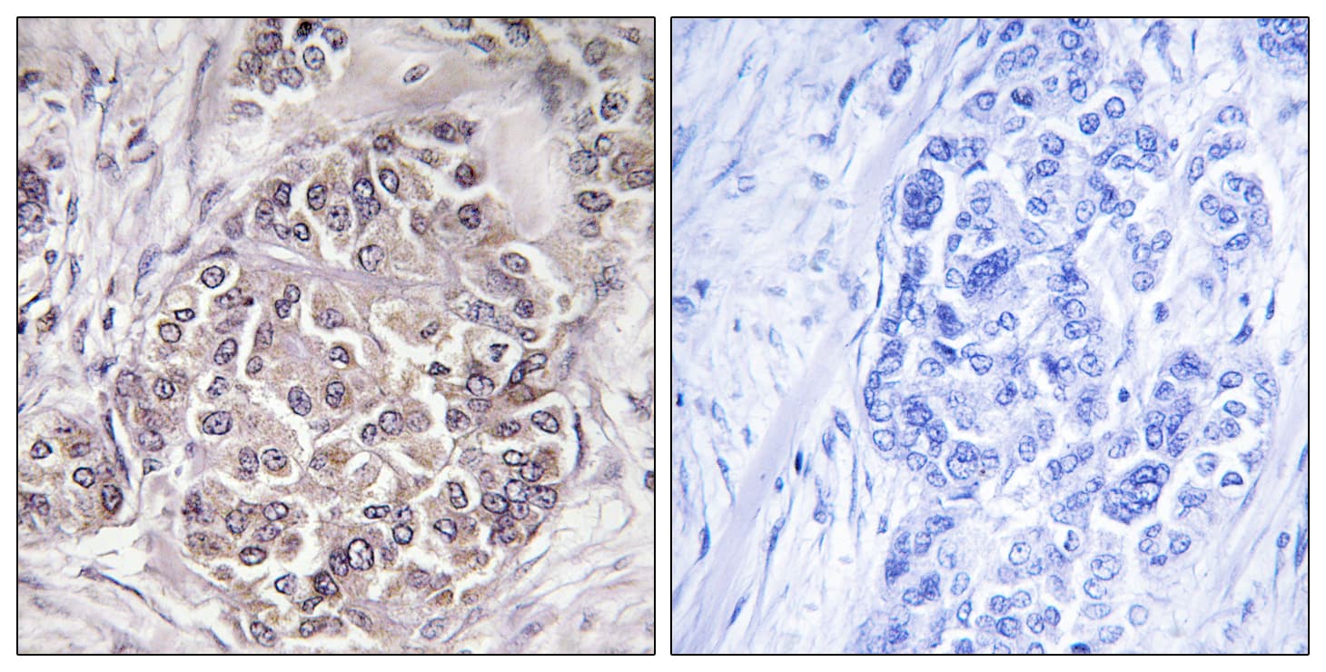 PEX1 Antibody (aa1234-1283)