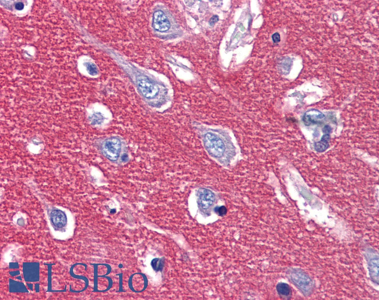 IHC-plus™ Polyclonal Rabbit anti-Human CADM2 Antibody (Internal, IHC)