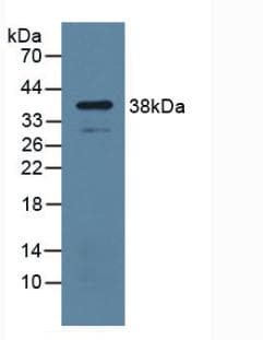 UP / UPP1 Antibody (aa1-277, APC)