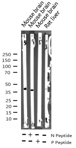 Polyclonal Rabbit anti-Human EIF2S1 Antibody (phospho-Ser51, IHC, IF, WB)
