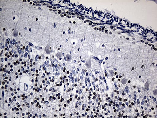 PHF20L1 Antibody (clone OTI3F3)