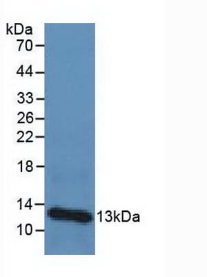 B2M / Beta 2 Microglobulin Antibody (aa1-142)