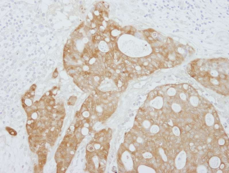 Polyclonal Rabbit anti-Human SFN / Stratifin / 14-3-3 Sigma Antibody (aa198-248, IHC, IF)