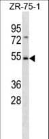 SHFM3 / FBXW4 Antibody (aa341-370)