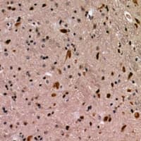 Polyclonal Rabbit anti-Human AMPD1 Antibody (IHC, WB)