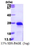 Human CRYGS Protein (Recombinant His)