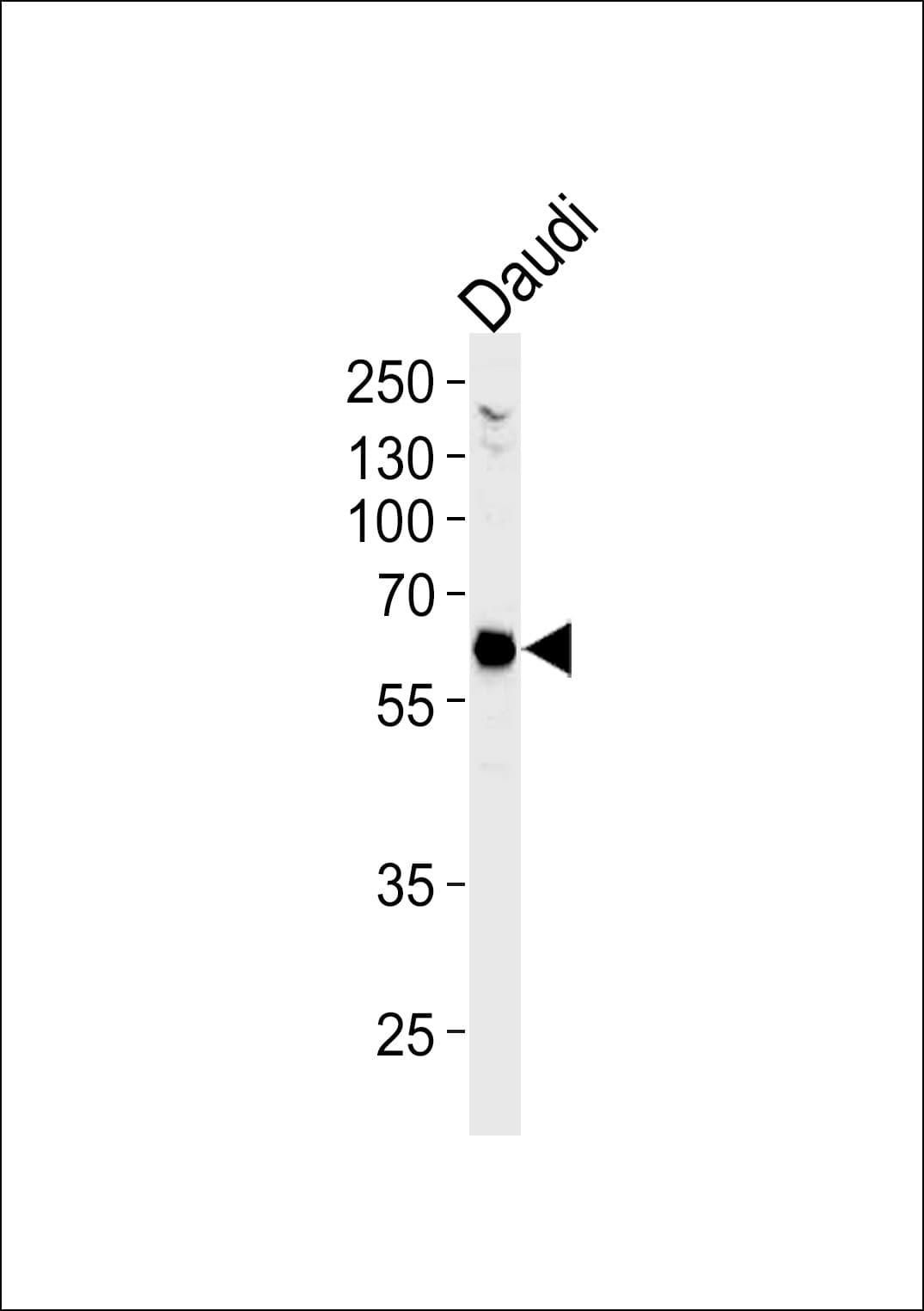 USP22 Antibody (clone 1154CT13.1.3.1)