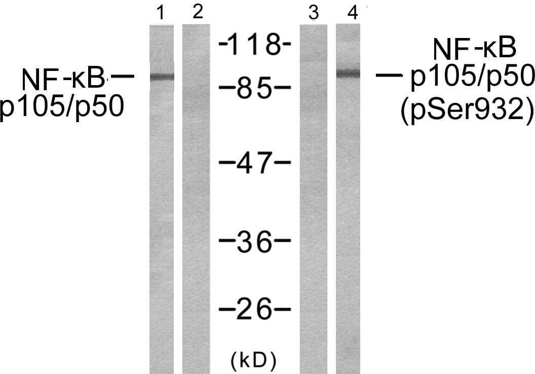 NFKB1 / NF-Kappa-B Antibody (phospho-Ser932)