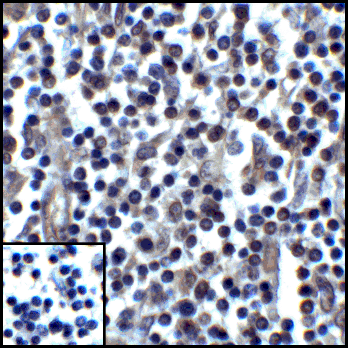 Monoclonal Mouse anti-Human CD274 / B7-H1 / PD-L1 Antibody (clone 2D6, IHC, IF, WB)