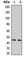 Polyclonal Rabbit anti-Human POC1A / SOFT Antibody (IF, WB)