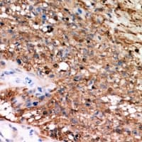 ARA9 / AIP Antibody