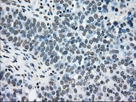 TYRO3 Antibody (clone OTI5B4)