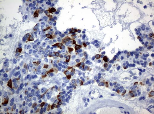 KRT19 / CK19 / Cytokeratin 19 Antibody (aa240-390, clone UMAB2)