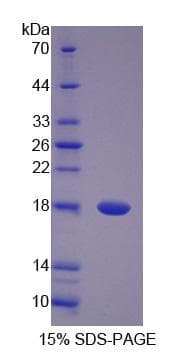 Human PANK4 Protein (Recombinant His-S)