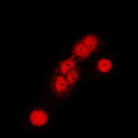 Polyclonal Rabbit anti-Human CUL1 / Cullin 1 Antibody (C-Terminus, IHC, IF, WB)