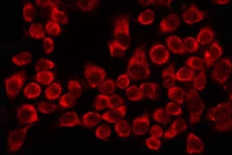 Polyclonal Rabbit anti-Human CCT8 Antibody (IF, WB)