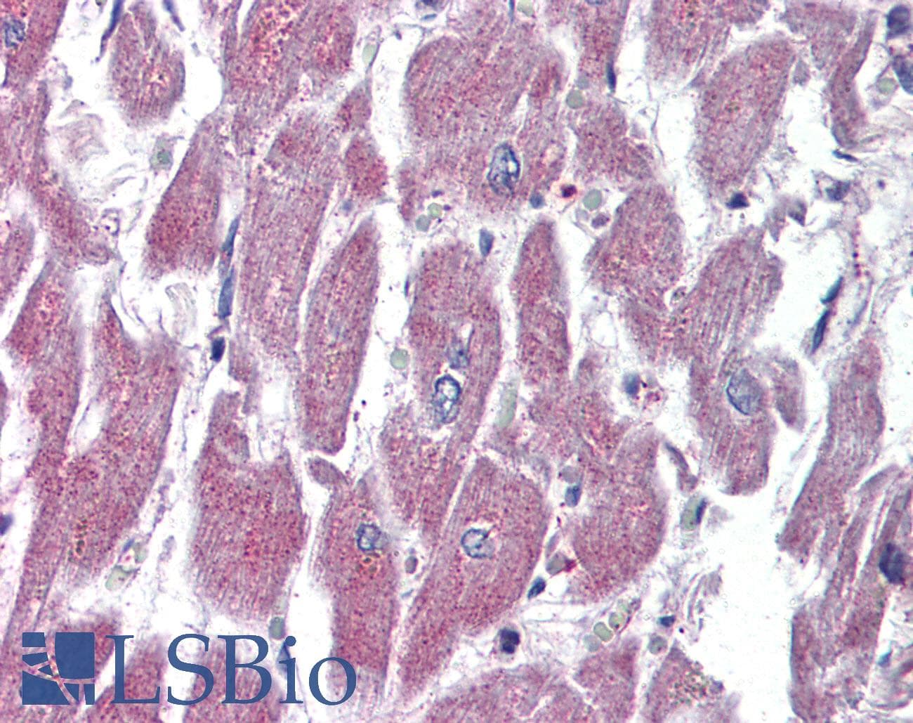 IHC-plus™ ADGRF5 / GPR116 Antibody (Internal)