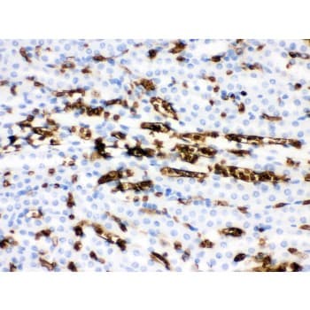 SLC4A1 / Band 3 / AE1 Antibody (aa28-365)