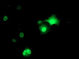 Monoclonal Mouse anti-Human AP50 / AP2M1 Antibody (clone OTI1F10, IF, WB)