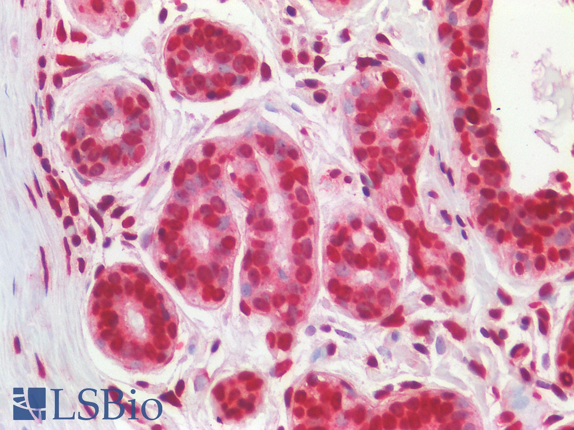 IHC-plus™ Polyclonal Rabbit anti-Human SREBF2 / SREBP2 Antibody (aa455-469, IHC, WB)
