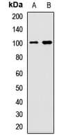 Polyclonal Rabbit anti-Human BRD7 Antibody (WB)