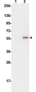 AKT1 Antibody (phospho-Ser473, clone 17F6.B11)