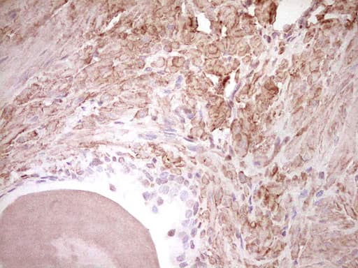 NR3C1/Glucocorticoid Receptor Antibody (aa1-265, clone OTI4C9)