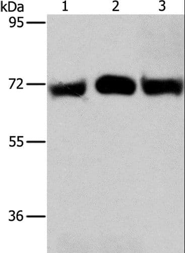 Polyclonal Rabbit anti-Human RPN1 / Ribophorin I Antibody (IHC, WB)